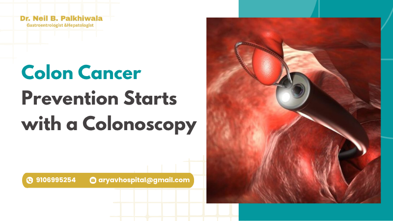 Colon Cancer Prevention Starts With A Colonoscopy